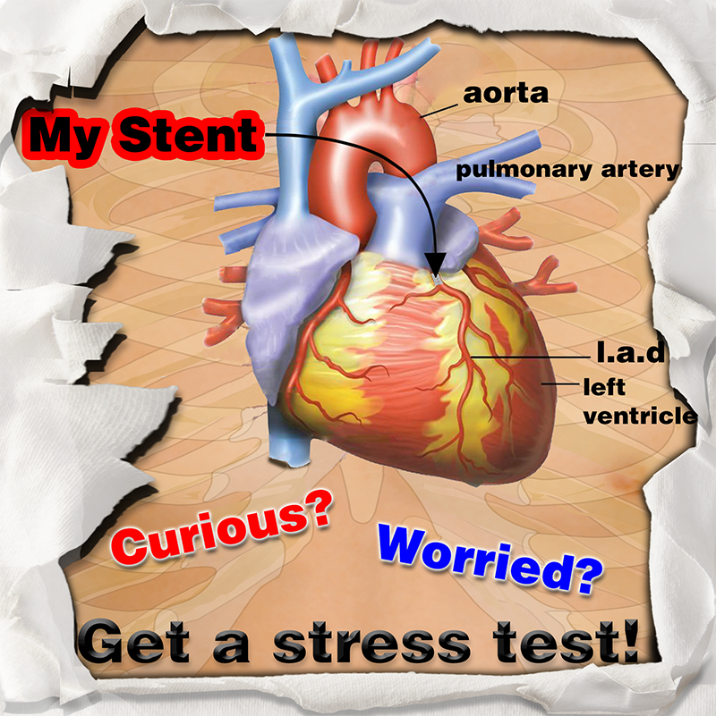 Stent Closeup